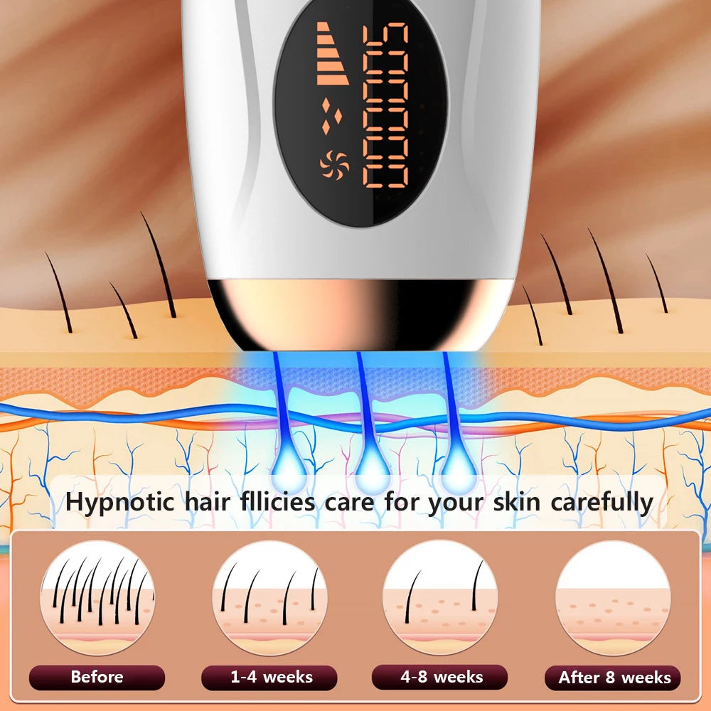 IPL Laser Hair Removal